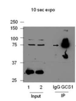 GCS1 Antibody, Novus Biologicals 0.1mL; Unlabeled:Antibodies, Polyclonal